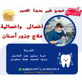اخصائي  علاج جزور اسنان